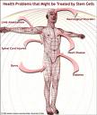 Buy Neurologic Diseases Medication Online - Mexico Pharmacy